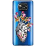 Силіконовий чохол BoxFace Xiaomi Poco X3 Heart (941290-rs11)