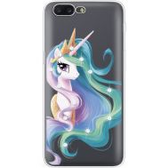 Силіконовий чохол BoxFace OnePlus 5 Unicorn Queen (935825-rs3)