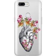 Силіконовий чохол BoxFace OnePlus 5T Heart (935796-rs11)