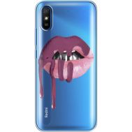 Силіконовий чохол BoxFace Xiaomi Redmi 9A (40305-cc17)