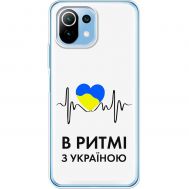 Чохол для Xiaomi Mi 11 Lite MixCase патріотичні в ритмі з Україною