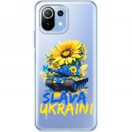 Чохол для Xiaomi Mi 11 Lite MixCase патріотичні Slava Ukraini