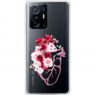 Чохол для Xiaomi 11T / 11T Pro Mixcase квіти серце поросло квітами