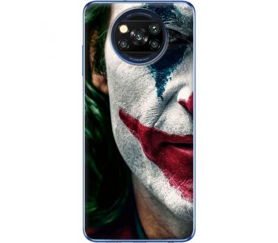 Силіконовий чохол Remax Xiaomi Poco X3 Joker Background