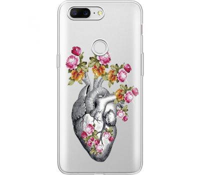 Силіконовий чохол BoxFace OnePlus 5T Heart (935796-rs11)