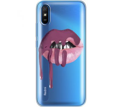 Силіконовий чохол BoxFace Xiaomi Redmi 9A (40305-cc17)