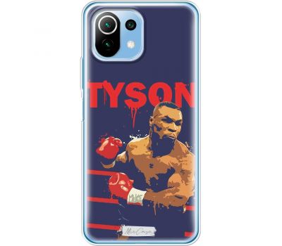 Чохол для Xiaomi Mi 11 Lite Mixcase бойові мистецтва Tyson
