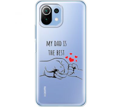 Чохол для Xiaomi Mi 11 Lite MixCase День батька My DAD is the Best