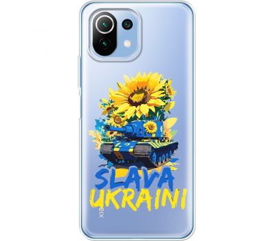 Чохол для Xiaomi Mi 11 Lite MixCase патріотичні Slava Ukraini